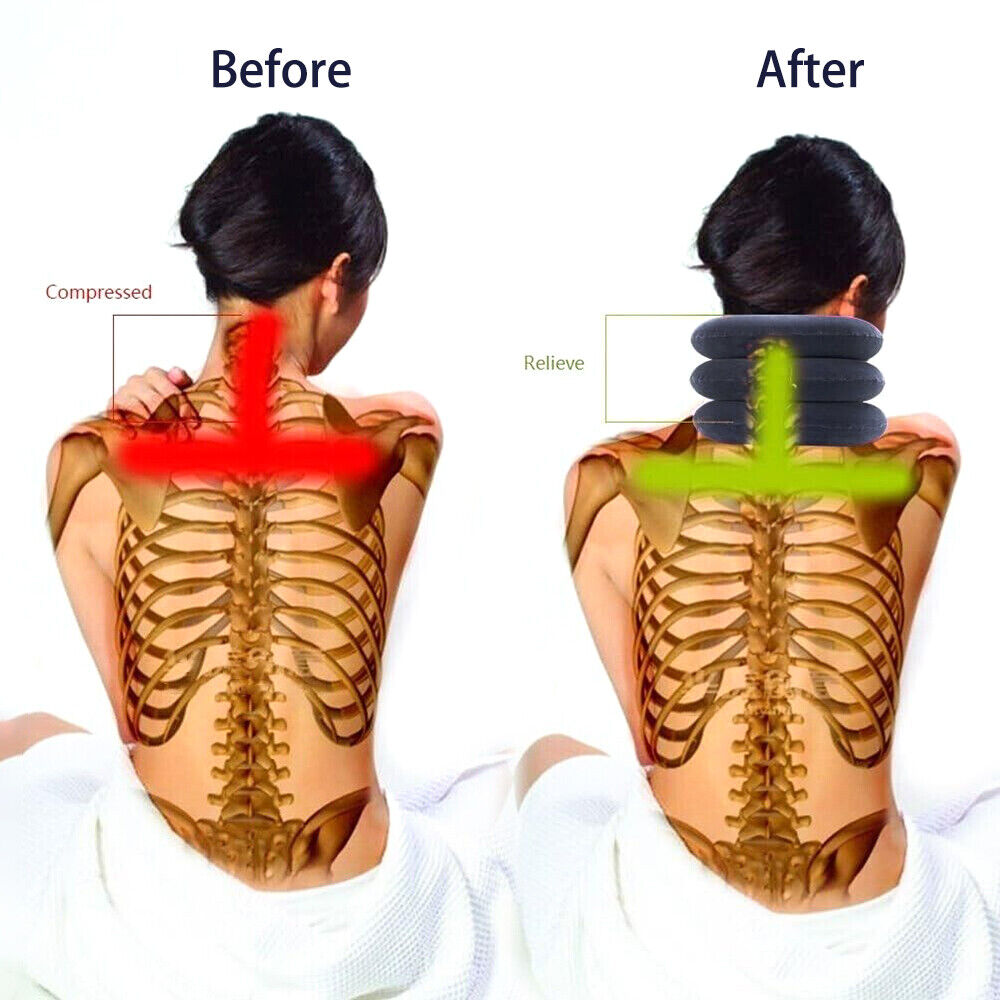 Align Neck Traction Collar – Cervical Support